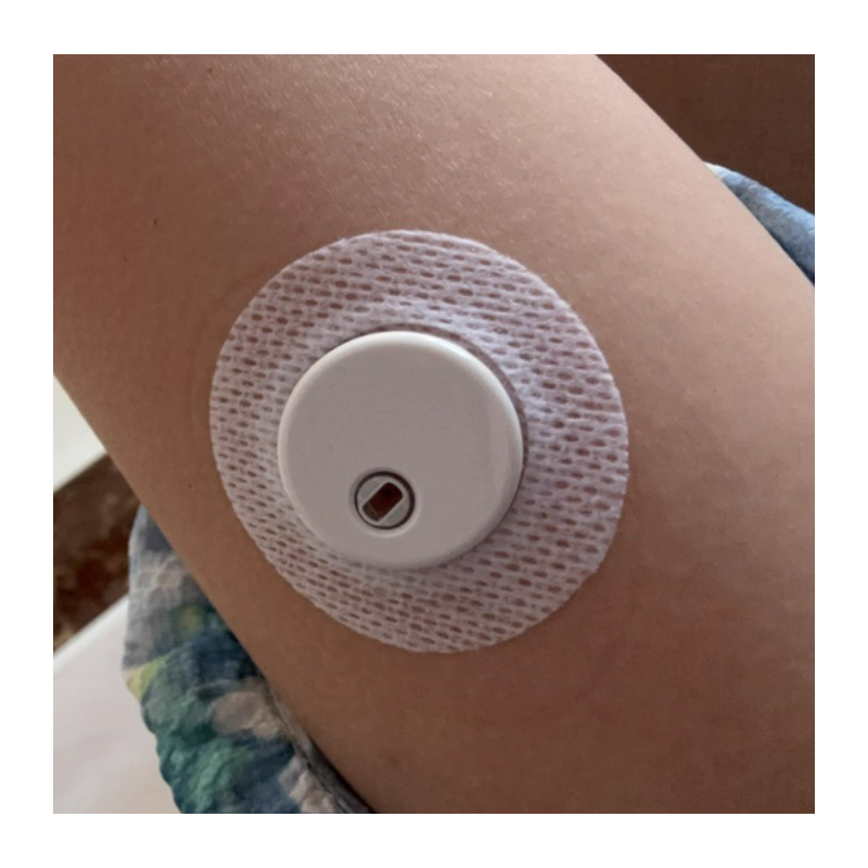 Originele Linx Sensor Patches  - Medical X recensie en prijs